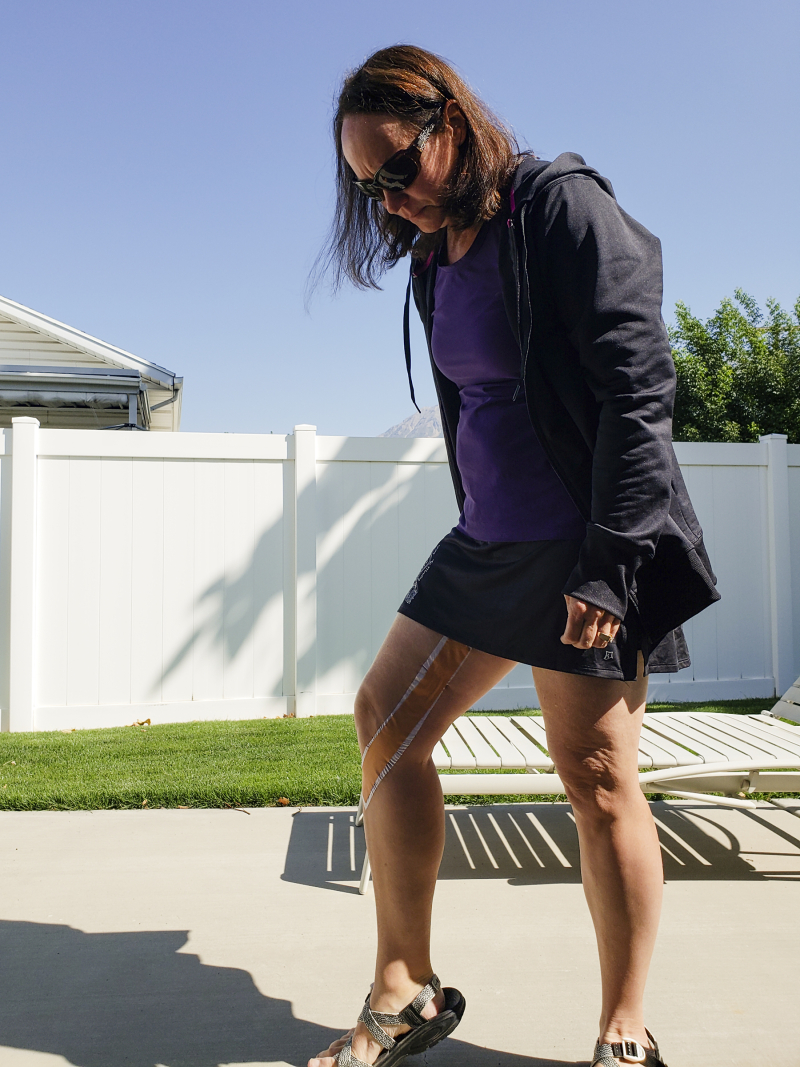 12 knee recovery 12 knee recovery